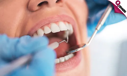 Composite Veneers + Scaling + Polishing & More!